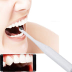 HD USB Dental Camera